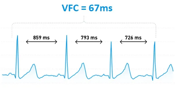 Graphique des battements cardiaques montrant la différence de durée entre deux battements