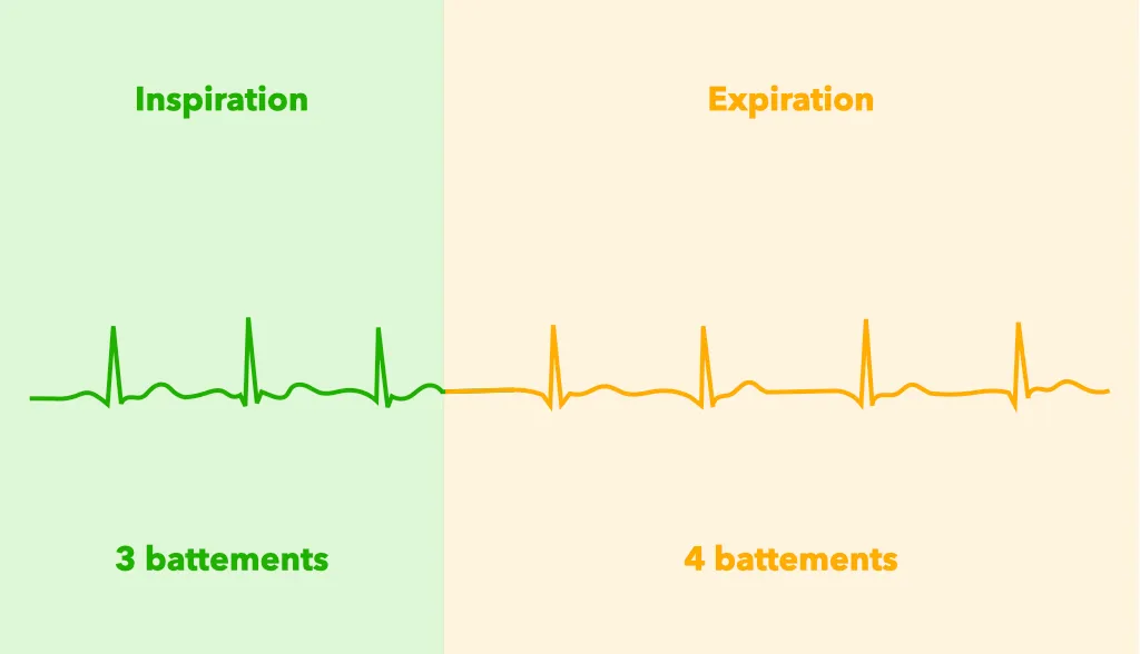 Graphique de battements de cœur mettant en évidence l'arythmie sinusale respiratoire